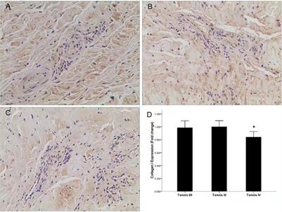 Collagen I in the Hip Capsule Plays a Role in Postoperative Clinical Function in Patients With Developmental Dysplasia of the Hip